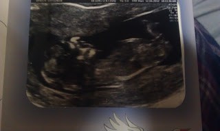 Pregnancy update - 18 weeks 4 nicholas number 2 12 weeks